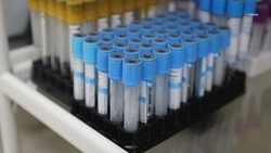 Проверяться на гепатит C нужно ежегодно — минздрав Ставрополья 