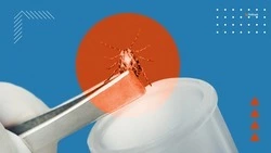 Осторожно — клещи: как защититься и что делать при укусе