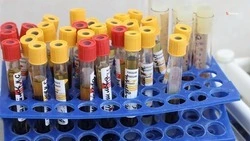 Свыше 238 тыс. ставропольцев победили COVID-19 с начала пандемии
